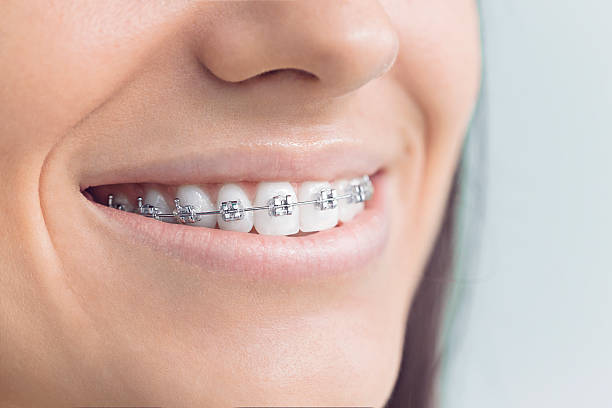Professional Holistic Dental Care Services in Limestone Creek, FL